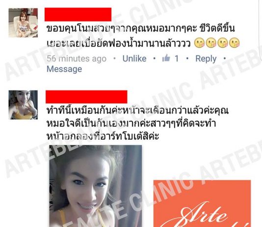 คำวิจารณ์อาร์ทโบเต้