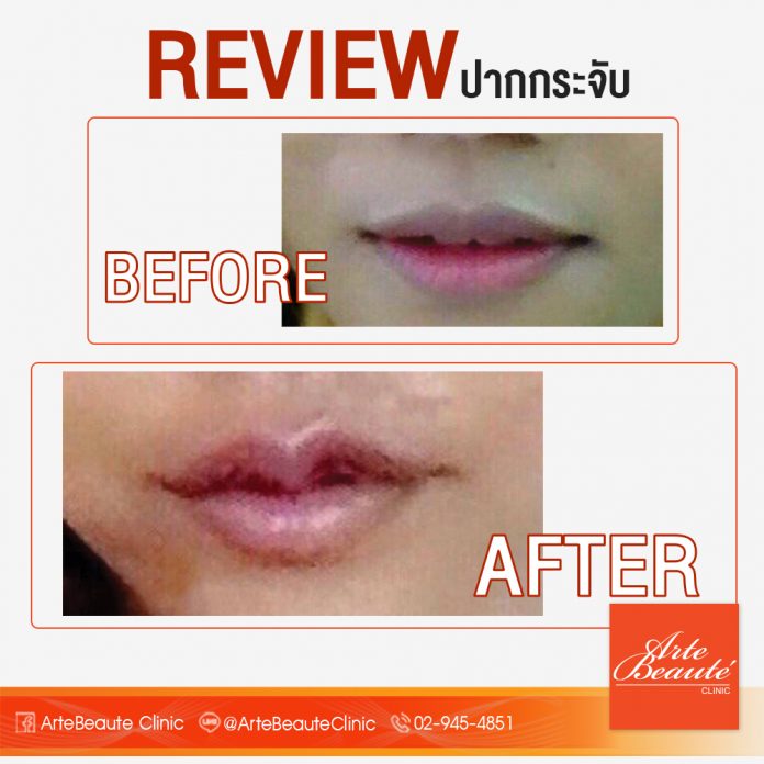 ทำปากกระจับ