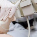 การตรวจหาเนื้องอกเต้านม