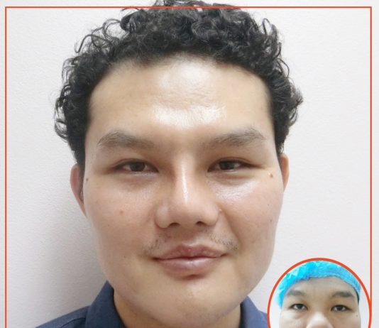 ทำปาก ทำปากกระจับ