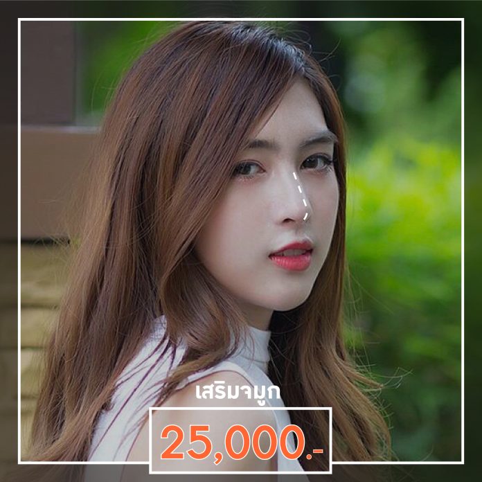 โปรเสริมจมูก by AreBeaute Clinic